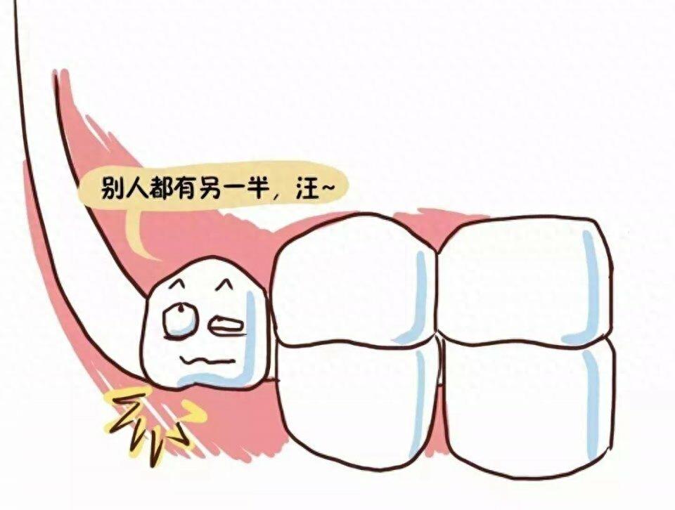 七张图带你看智齿