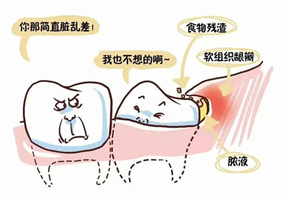七张图带你看智齿