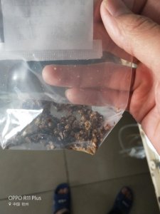 ​看看肾结石取出来的石头！一定要多喝水！
