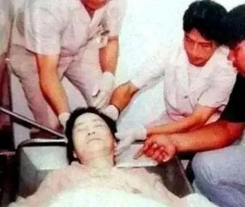 ​一代歌后邓丽君的死扑朔迷离，据法医记载；邓耳朵后方有许多针孔