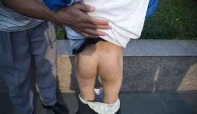 ​男童被老师打屁股700次 学校和老师负什么责任