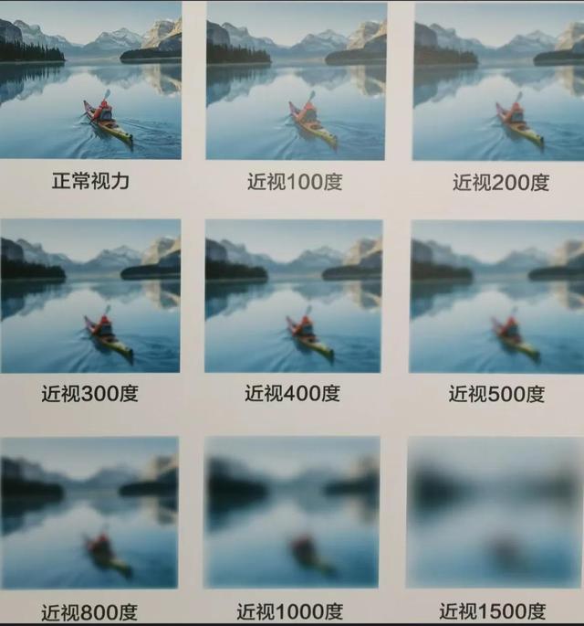 近视眼的明星后来都怎么样了 近视眼的明星有哪些(24)