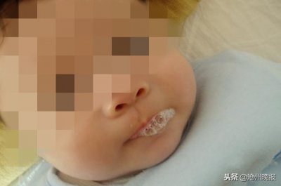 ​婴儿爱吐泡泡，竟是得了肺炎