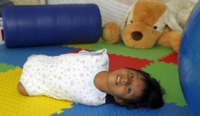 ​直击一位罕见的四肢全无女孩8张催泪照