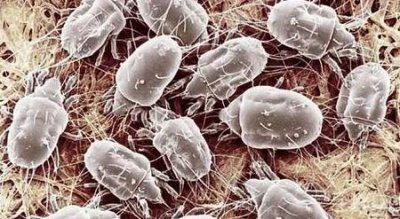 ​怎么判断自己脸上有没有螨虫(怎样才知道自己脸上有没有螨虫)